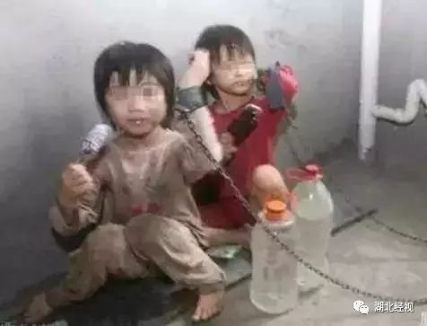 眼球被挖了一个洞还能恢复吗,眼球被挖了之后眼皮还能睁开吗