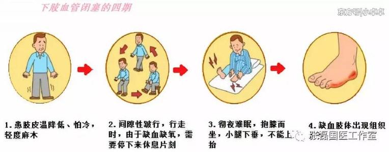 走路后腿酸痛怎么治疗,走路后腿疼怎么快速缓解