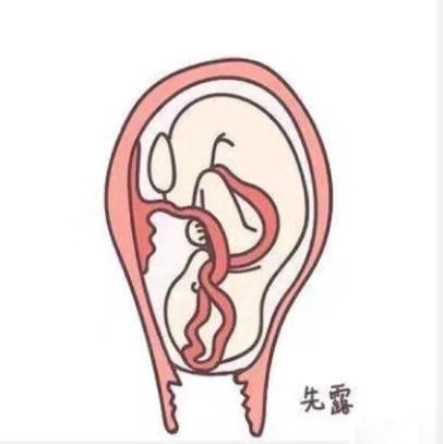 婆婆不让宝宝吸母乳,宝宝不愿意吸母乳小妙招