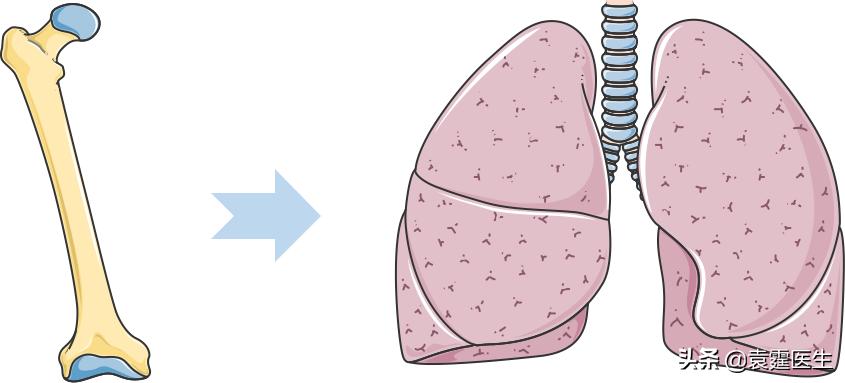 骨肿瘤科普视频,骨肿瘤知识