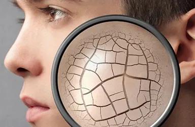 皮肤缺水的6大原因，你知道吗？