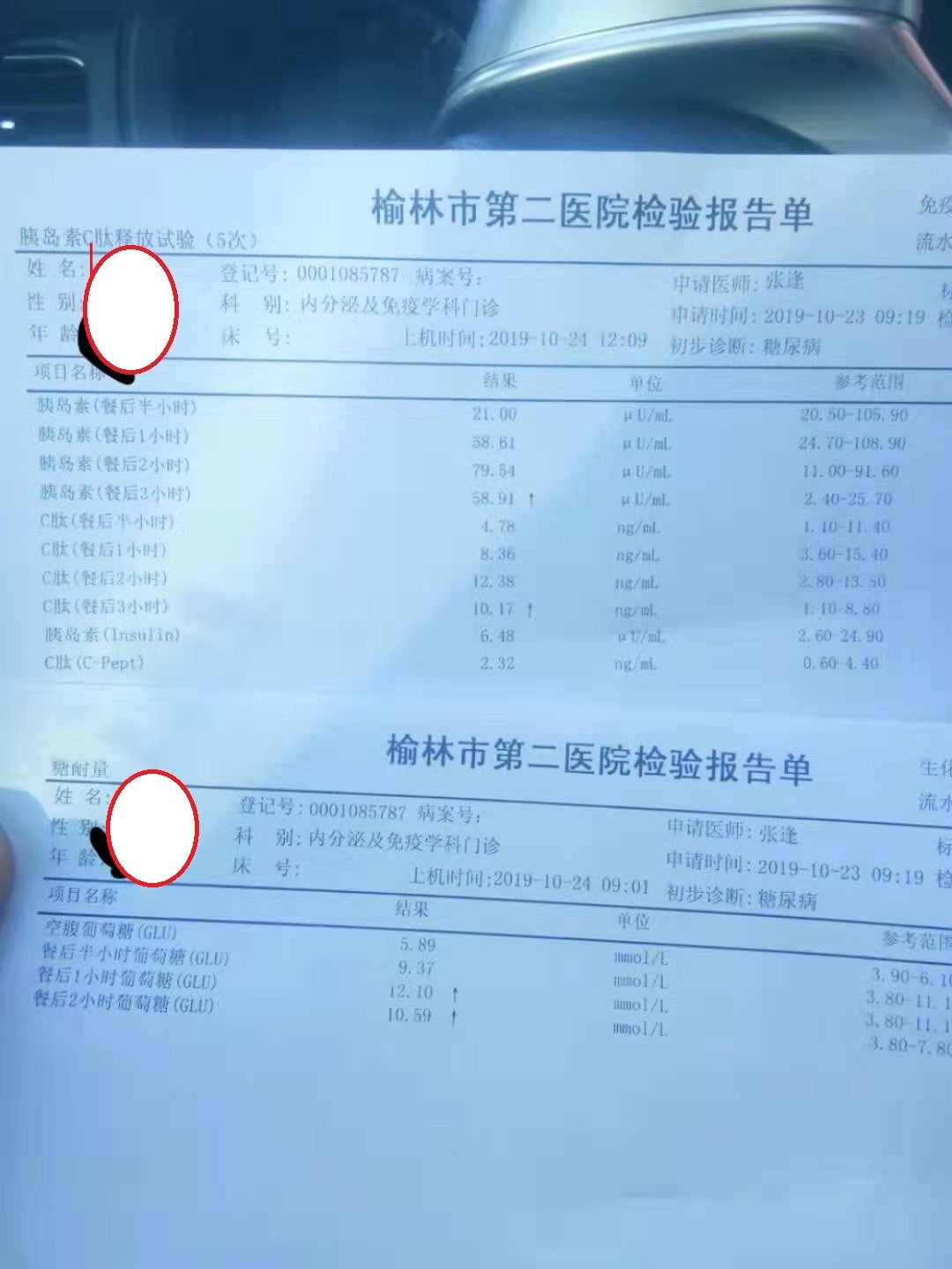 胰岛素延迟和胰岛素抵抗区别,胰岛素高峰延迟是胰岛素抵抗吗