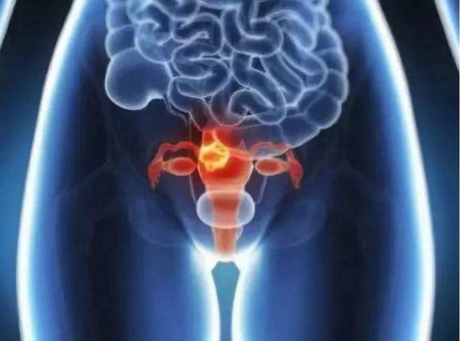 您也是这样的不老女神吗？小心癌症找上门!