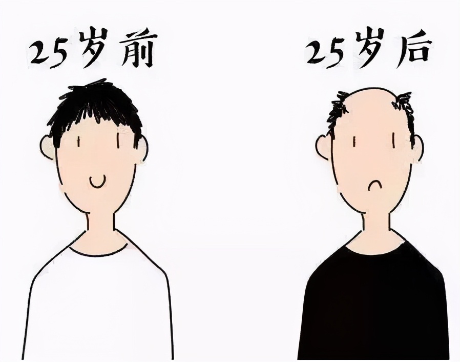 医生头发秃顶,医生都秃头吗