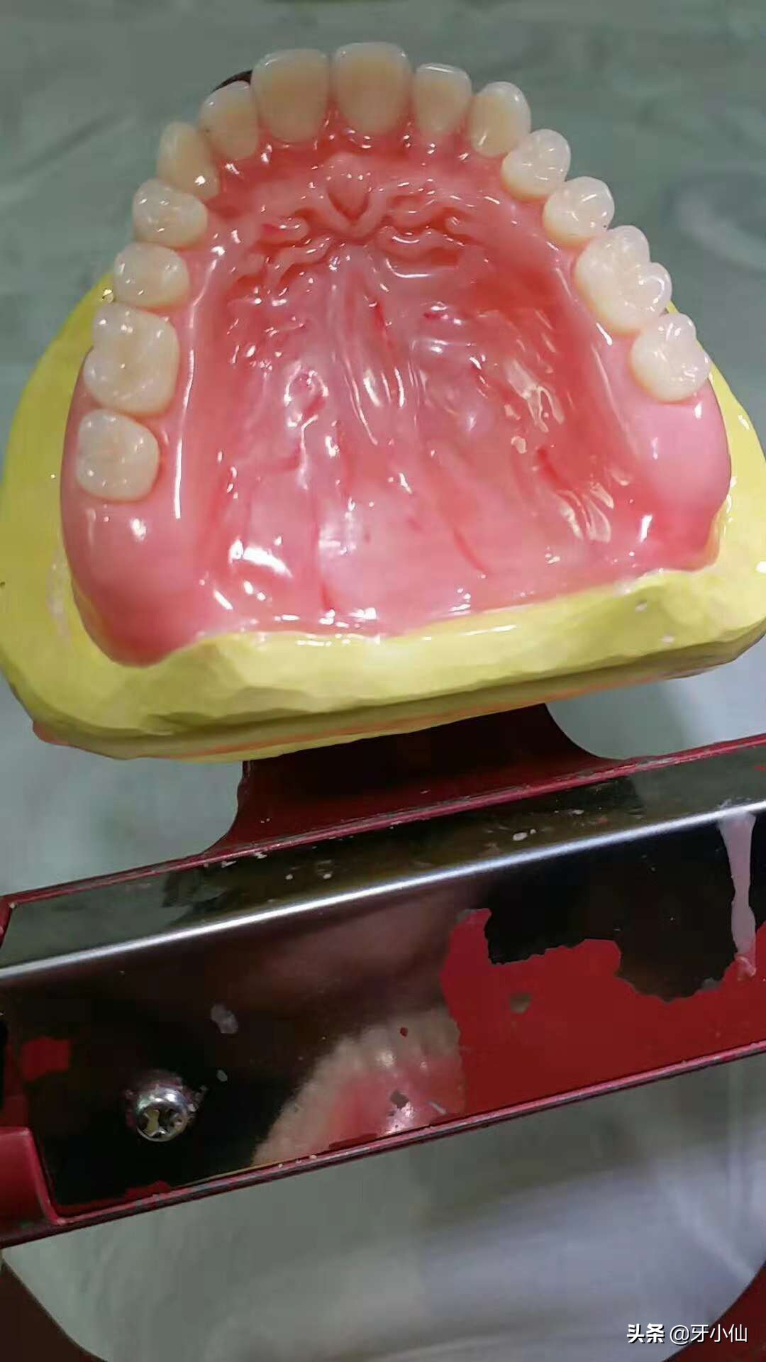 老人牙齿全坏了怎么办,老人牙掉了剩几颗怎么修复