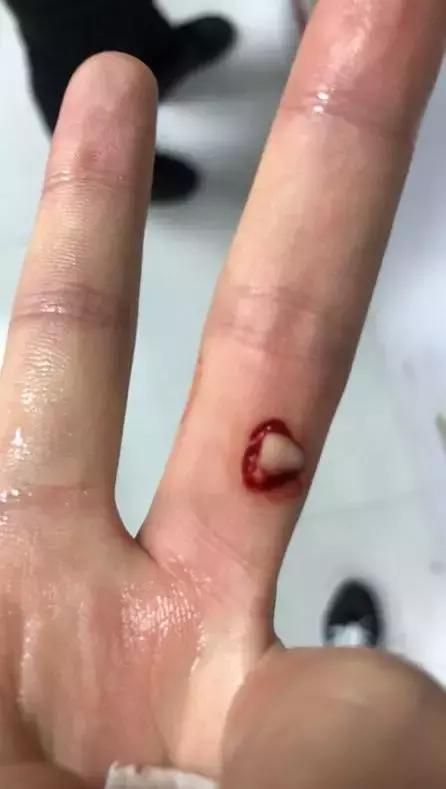 会咬鱼的观赏鱼,观赏鱼哪些不会咬人