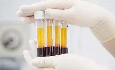 面部皮炎怎么鉴别图片,脂溢性皮炎在面部该怎么治疗