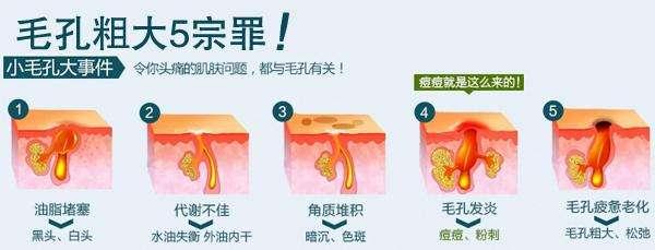 皮肤黑是什么原因,手掌皮肤粗糙是什么原因