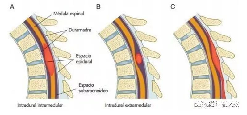 腰椎有哪些病变,腰椎病变有几种