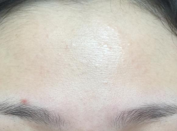 实战5年分享去闭口经验，含有大量干货！请查收