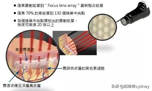 蜂巢皮秒祛斑一到七天变化图,蜂巢皮秒效果多久出来
