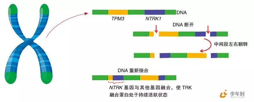 费城染色体形成原因,费城染色体会有什么影响