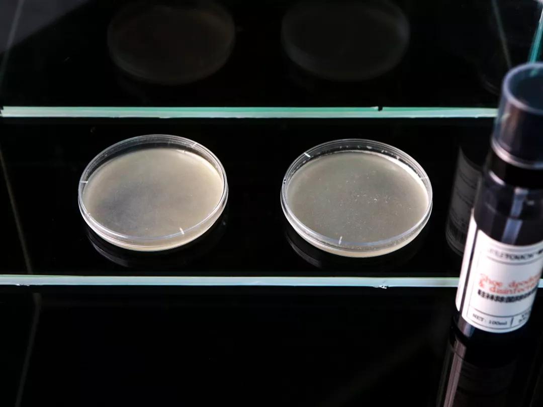 鞋袜去除异味的方法,如何解决鞋袜臭问题呢