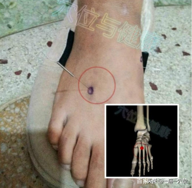 缓解女人痛经的穴位膝盖大腿内侧,女性痛经的特效药方