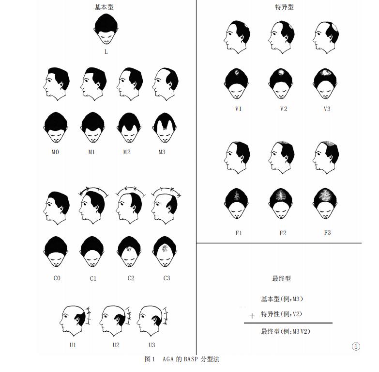 有没有治疗脱发的有效方法,中年人脱发原因及治疗方法