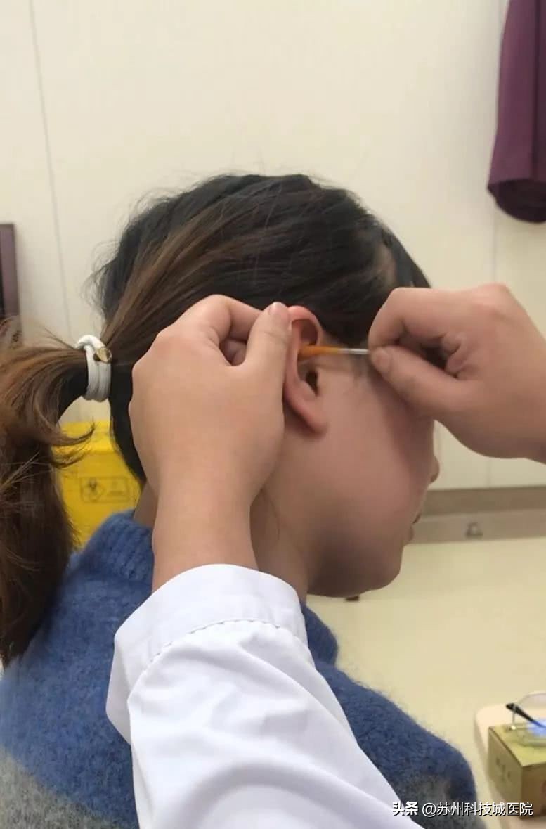 扎耳朵减肥效果好吗,耳针可以帮助减肥吗