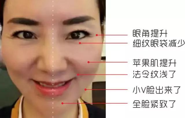 香港明星代言补水去黄提亮面膜,各路明星推荐的面膜怎么样