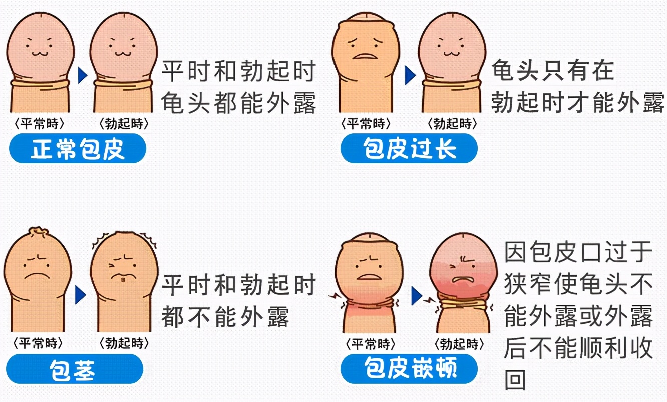 包皮切得太短了怎么办,包皮过长该不该割掉呢