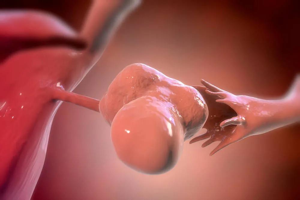 卵巢囊肿影响发育,卵巢囊肿影响胎儿发育吗