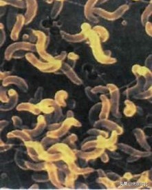 真菌与细菌细胞病毒区别,细菌病毒真菌微生物哪个厉害