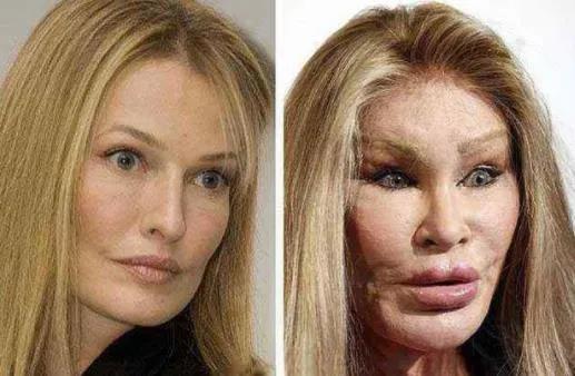 如果不想变“弱智和毁容”，请让你们的男朋友或老公这样做。