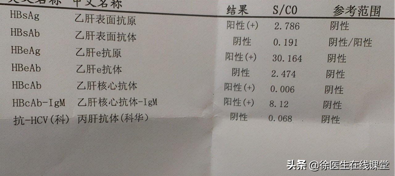 患上乙肝别害怕及时治疗是关键,发现乙肝该如何治疗最好