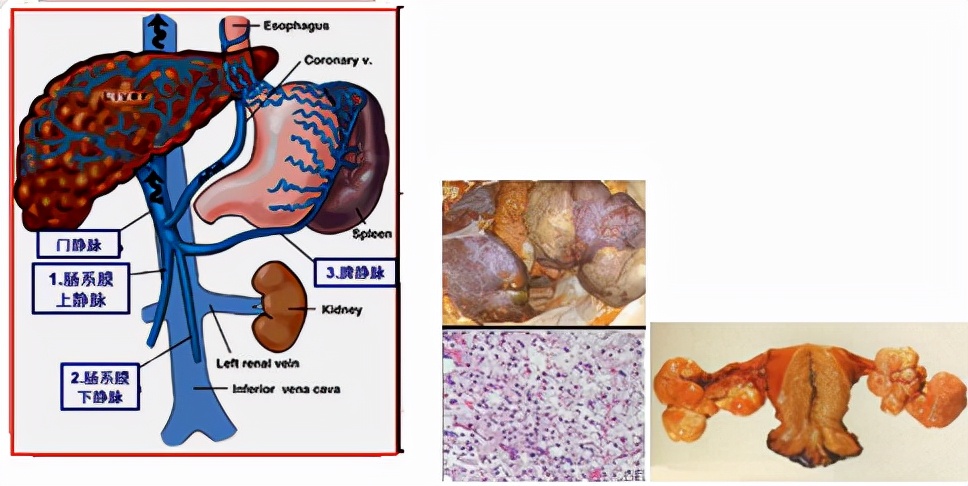 我不是药神，我不是财迷！若患胃癌，这些靶向药你有能力负担吗？