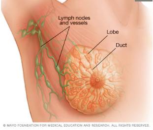乳腺癌15种锻炼方法,断食或能阻挡乳腺癌发展