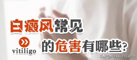 天津市白癜风的治疗较有效办法,白癜风症状天津红桥