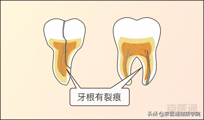 夜磨牙有什么危害吗,夜磨牙的危害