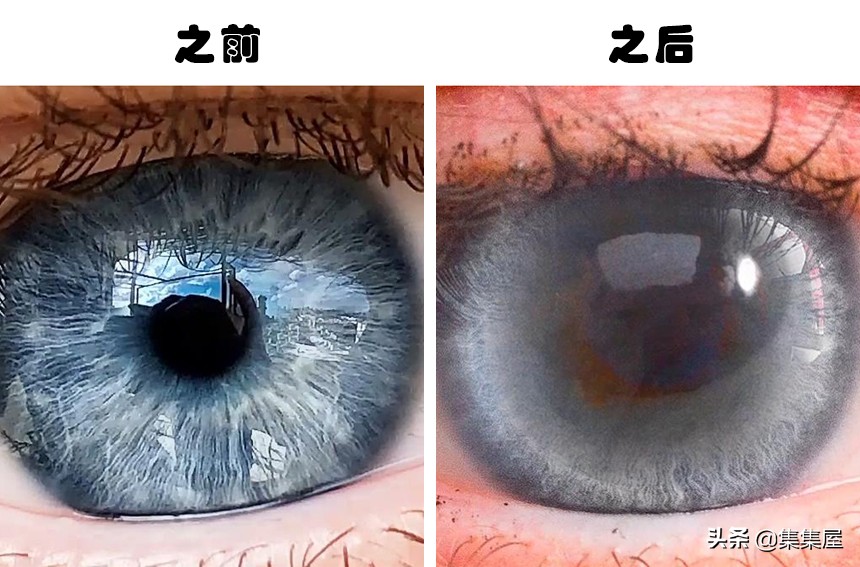 如果我们一直不眨眼会怎么样,如果我们连续一年只吃素会怎样