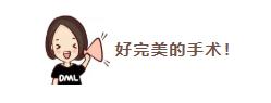 睾丸精索静脉曲张微创手术全过程,睾丸精索静脉曲张手术微创
