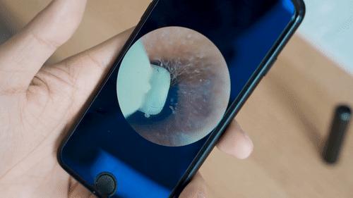 2岁宝宝掏出一长条耳屎,给宝宝掏出一堆耳屎