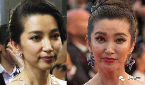 别光用眼霜！专家提醒：要想去除眼纹黑眼圈，这些方法最有效