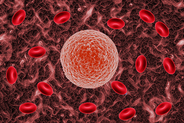 连续2次胎停，应该怎么办？不要过度自责，备孕前的检查很重要