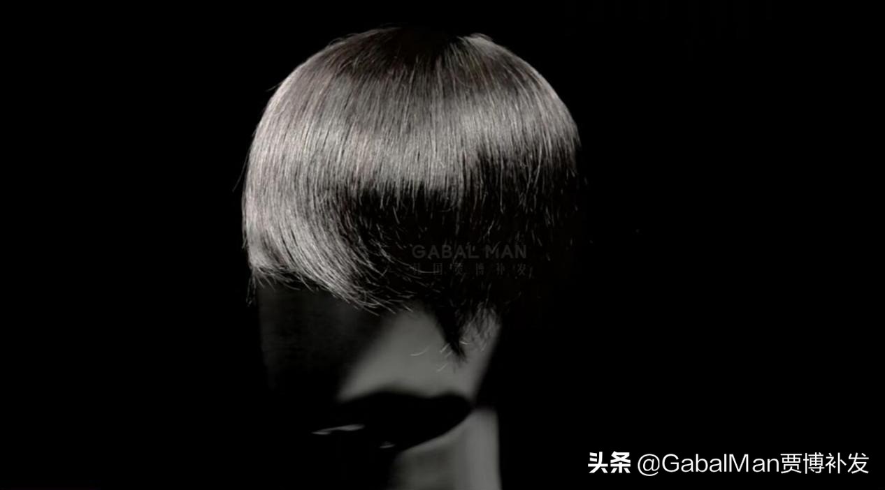 脱发不长发是什么原因,脱发不想戴假发