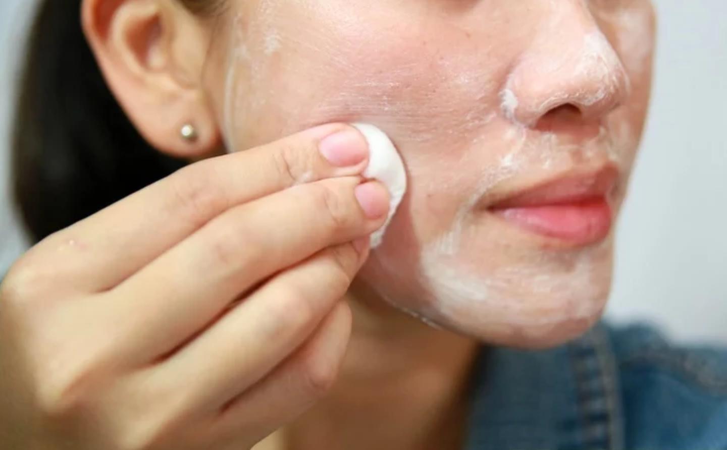 还在为脸上的皱纹发愁吗,有点严重的雀斑该怎么去