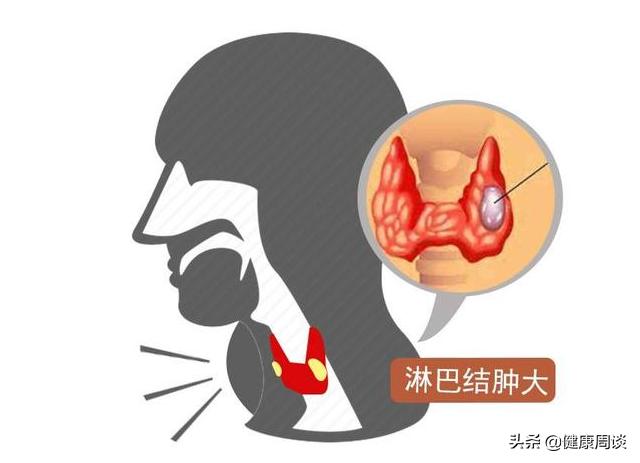 身上突发的肉疙瘩是瘤？会癌变？医生：或与5种疾病有关，需留意