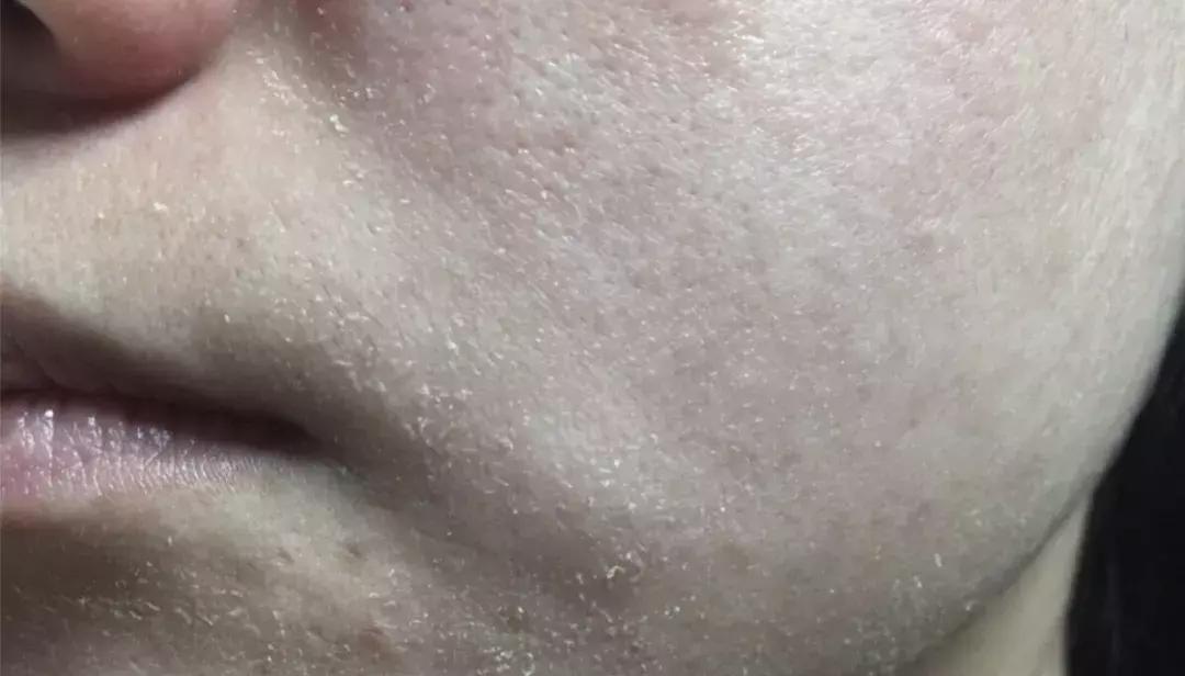 在家就能做的面部spa,在家可以做脸部spa吗