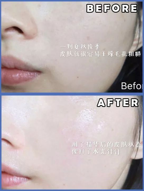 熬最深的夜，也要发最亮的光！烟酰胺精华，让你熬夜也有少女颜