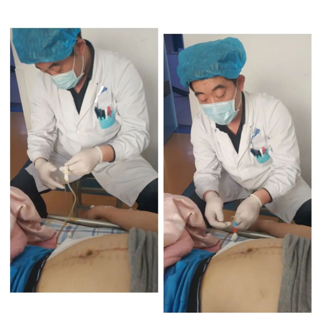 超声微创介入治疗,介入性超声诊疗