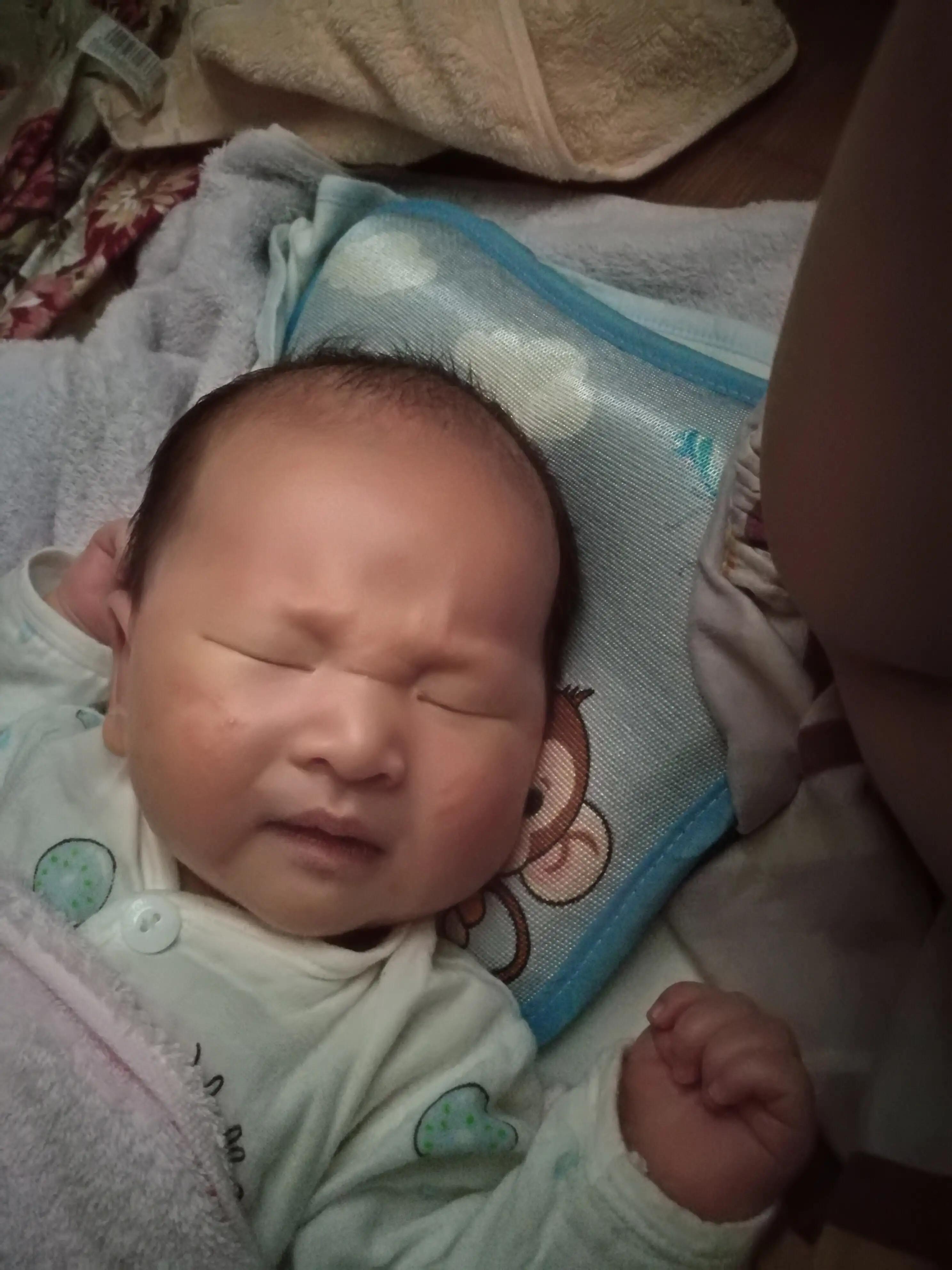 宝宝从出生要经历黄疸胀气,宝宝为什么会黄疸和湿疹