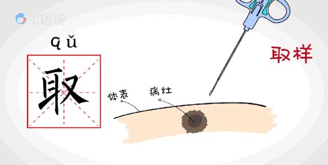 颅内肿瘤微创介入的条件,广东哪家医院肿瘤微创介入治疗好