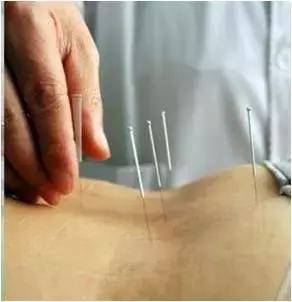 康复理疗馆如何,康复中心一日生活