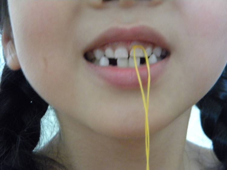 小孩长新牙需要多久,小孩长新牙应该关注哪些