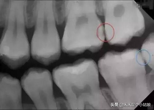 孩子不愿意看牙医心理疏导,小孩看牙医不老实又不听话怎么办