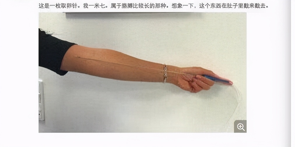 取女方卵子的针,取女性卵子过程痛苦吗