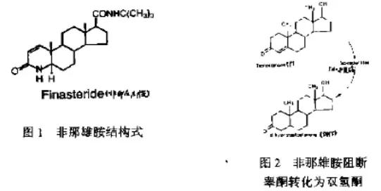 雄脱要去哪治疗,雄脱为什么没得治