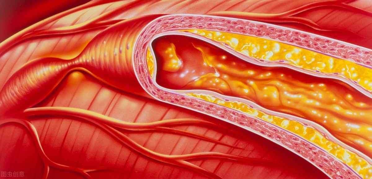 脑袋血管供血不够怎么办,血太浓血管堵