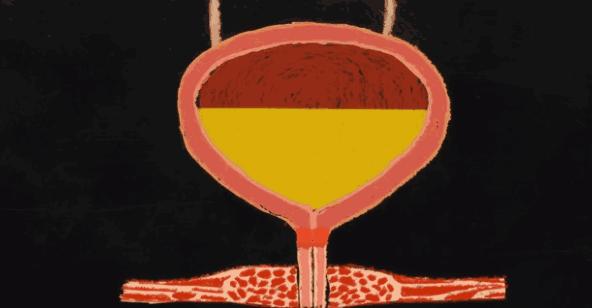 正常人憋尿多长时间有危险,防水需要关注事项